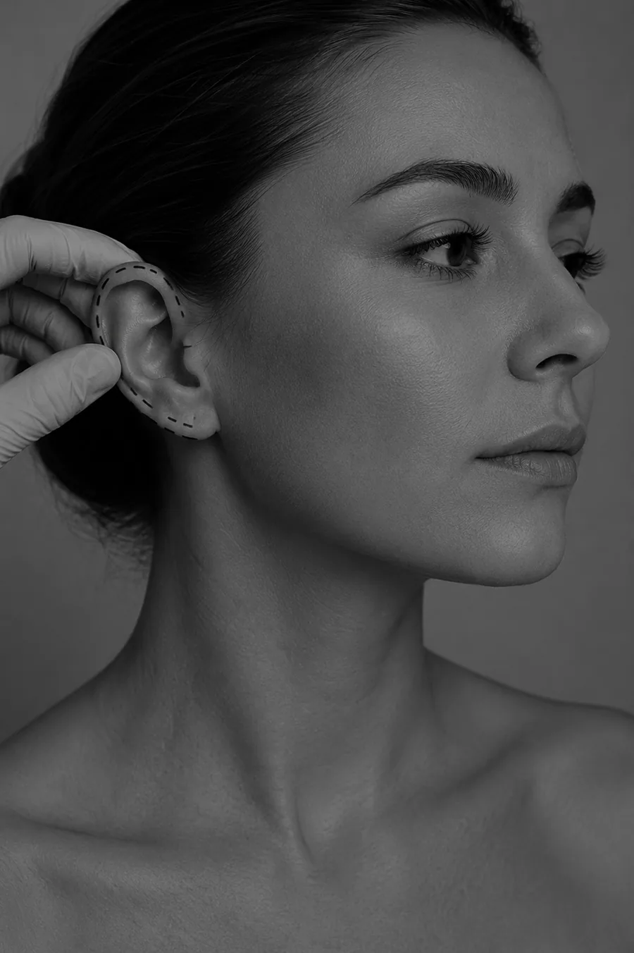 Otoplasty (Ear Surgery)